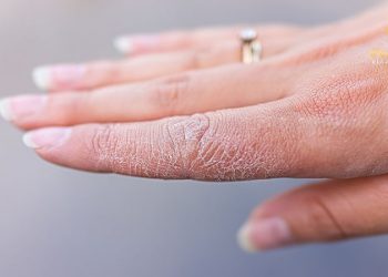 Cách dưỡng da tay bị khô