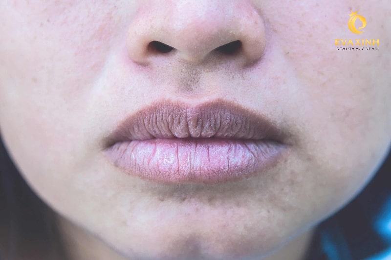 viền môi bị thâm sau khi xăm